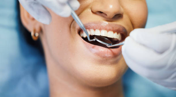 Best Emergency Dental Care for Broken or Chipped Teeth in Cheviot, OH